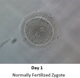 Embryo Development - Day 1