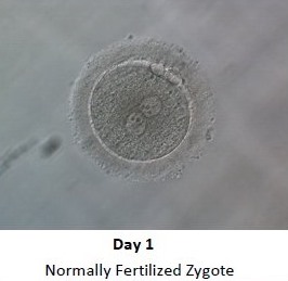 embryo-development-day-1 Embryo Development - Day 1