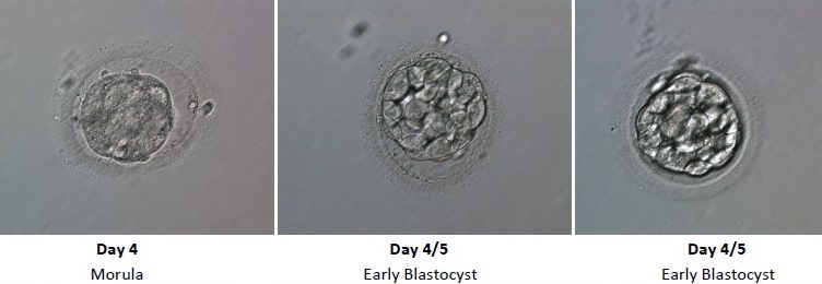 Embryo Development - Day 4 and 5