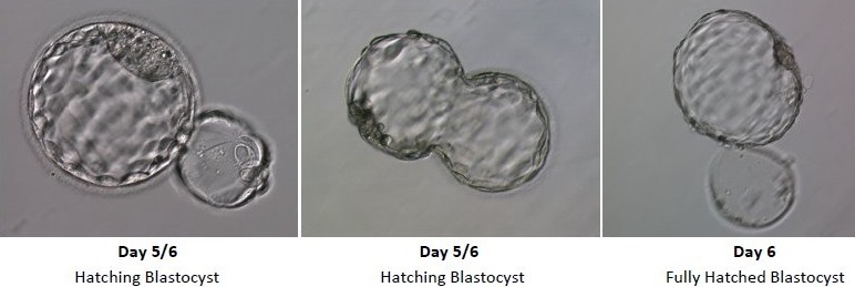 Embryo Development - Day 5 and 6
