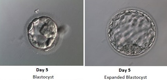 Embryo Development - Day 5