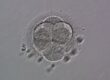Embryo Development in IVF - Wilcox Fertility
