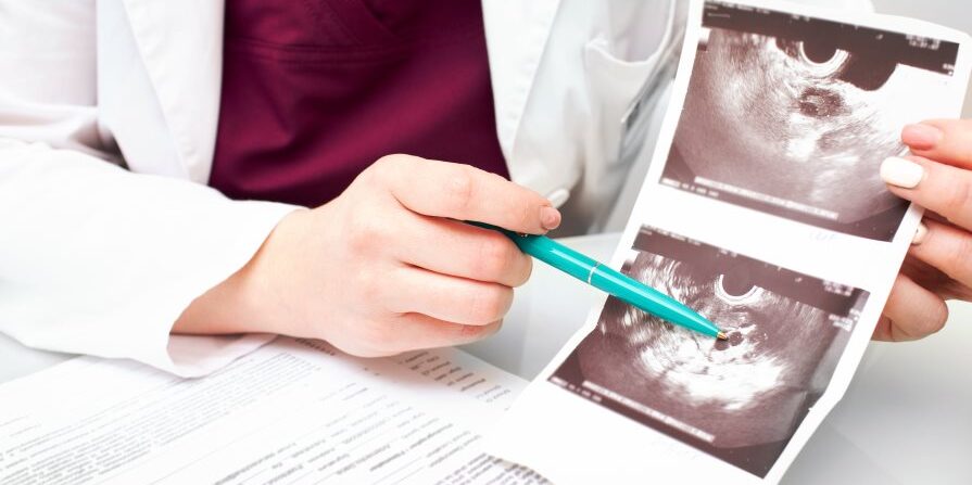 Follicles for IVF - Wilcox Fertility